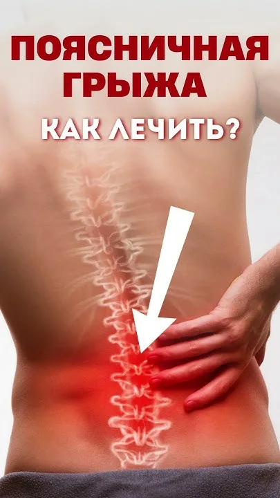 Остеохондроз, межпозвонковая грыжа
