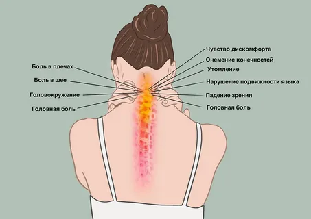 Как напряжение мышц шеи и плеч может быть связано с головной болью